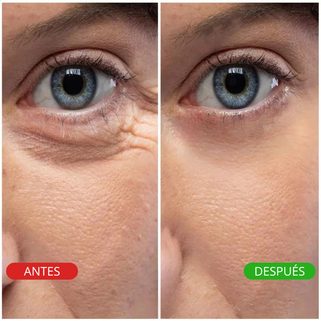 NATURAFULL™ (Pack 2 cajas ). 12 unidades. Parches de colágeno auto disolventes para OJERAS